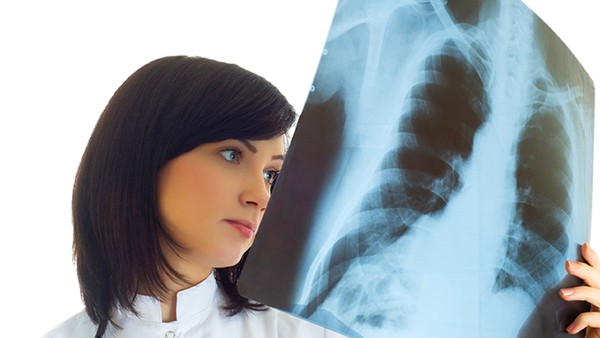 肺癌晚期患者咳嗽怎么办？（肺癌晚期患者吃什么止咳药？）