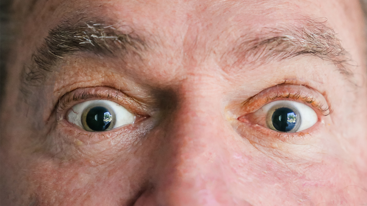 眼睛发痒、异物感、流泪或分泌物增多是怎么回事？（眼睛发痒、异物感、流泪或分泌物增多是什么原因引起的？）