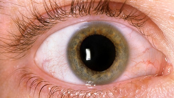 一个眼睛酸胀痛是干眼症吗